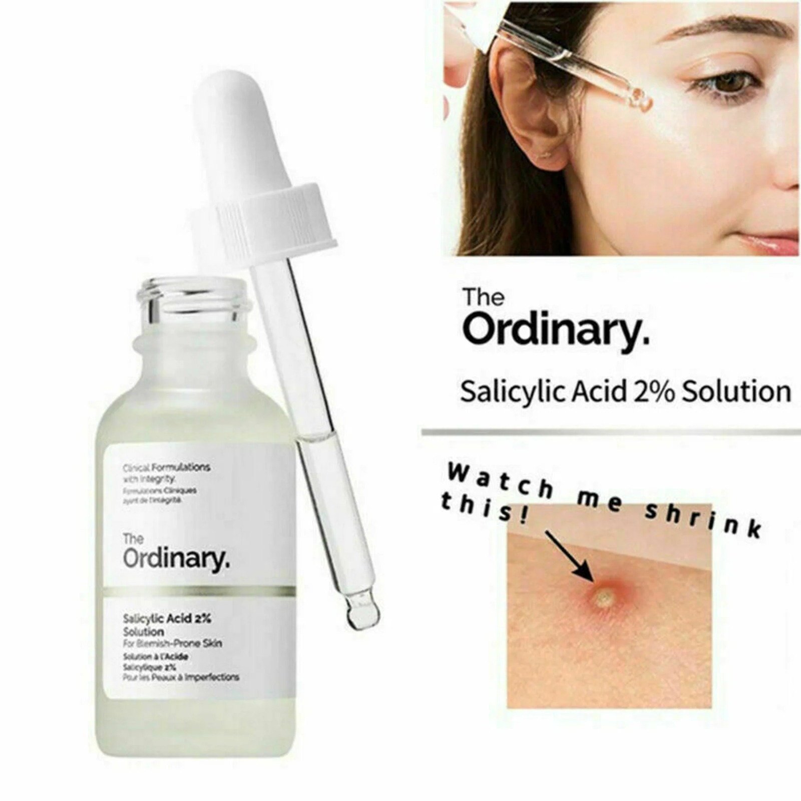 The Ordinary Salicylic Acid 2% Solution 30ml - Image 4