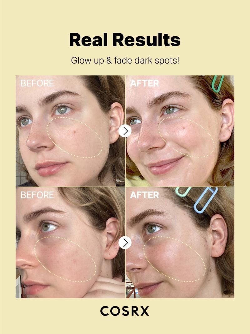 COSRX The Vitamin C 23% Hyaluronic Acid Serum - Image 6
