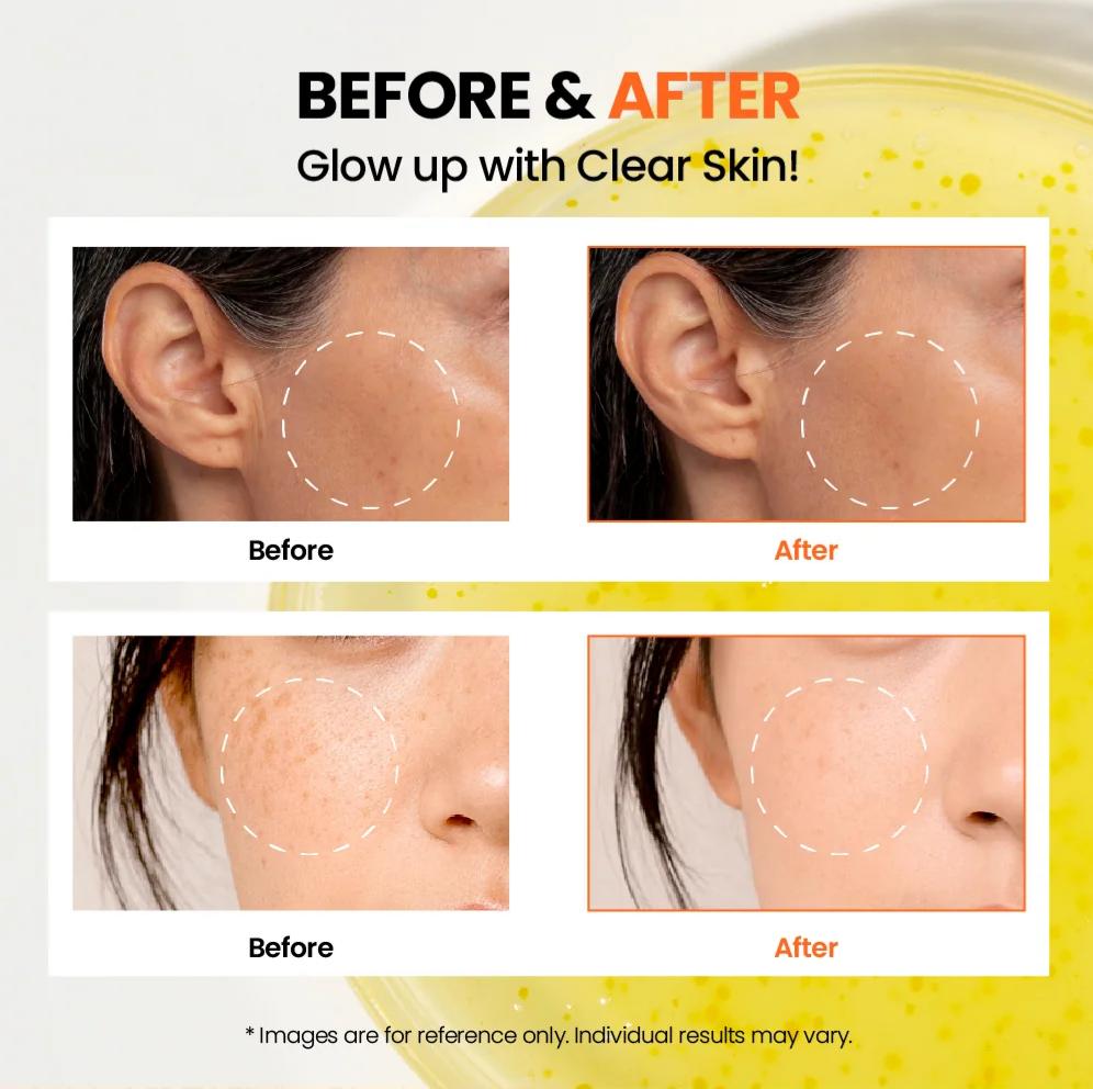 K-Secret SEOUL 1988 Glow Serum: Niacinamide 15% + Yuja 30ml - Image 2