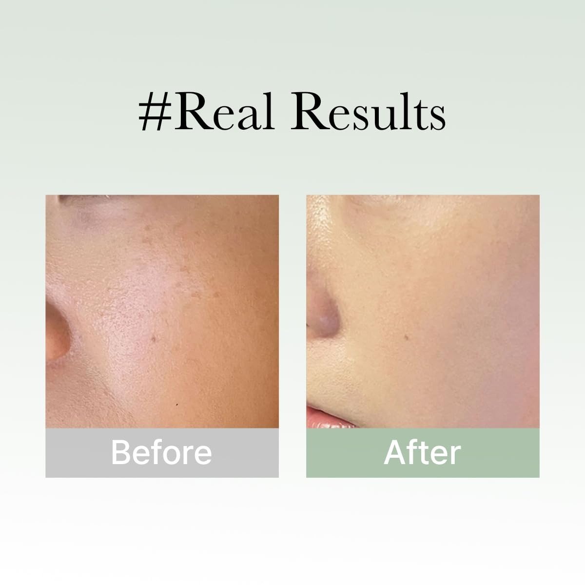 Arencia Holy Hyssop Serum - Image 3