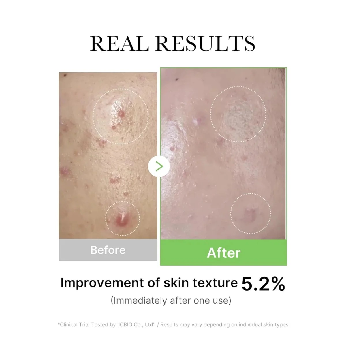 Medicube Exosome Cica Ampoule - Image 2