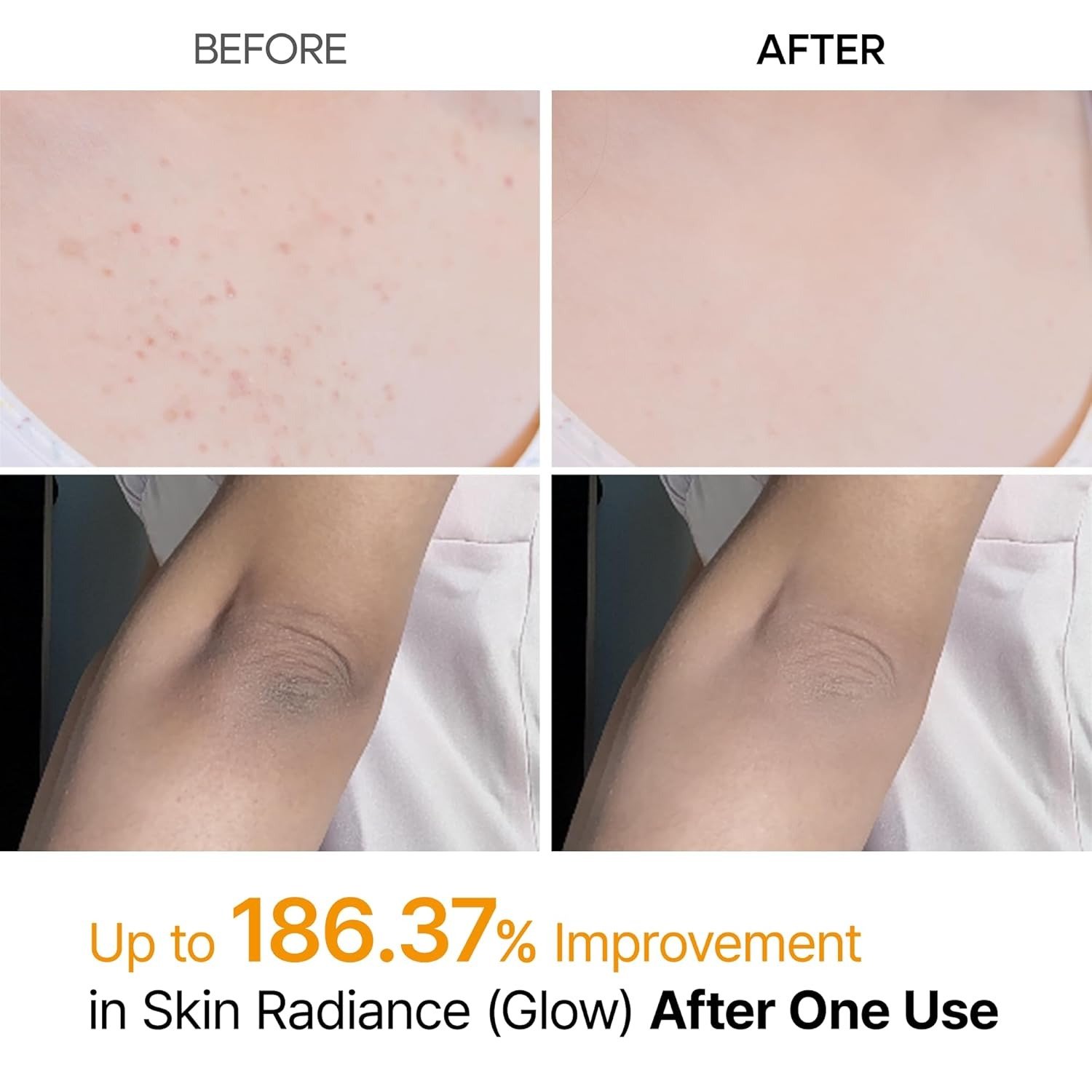 Dr. Melaxin Peel Shot Exfoliating Kojic Acid Turmeric Spray - Image 3