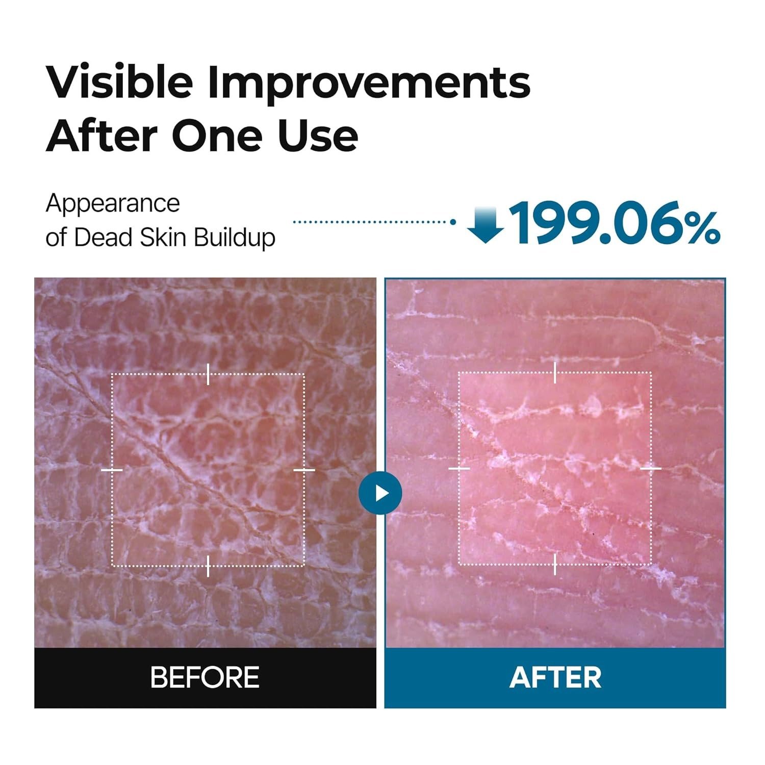 Dr. Melaxin Peel Shot Exfoliating TX-Spray (200ml) - Image 3