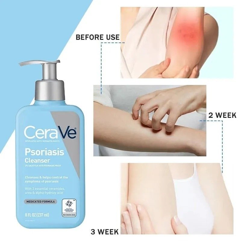 CeraVe Psoriasis Cleanser (237ml) - Image 2