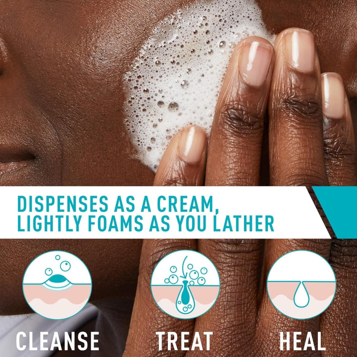 Cerave Acne Foaming Cream Wash 10% 150Ml - Image 3