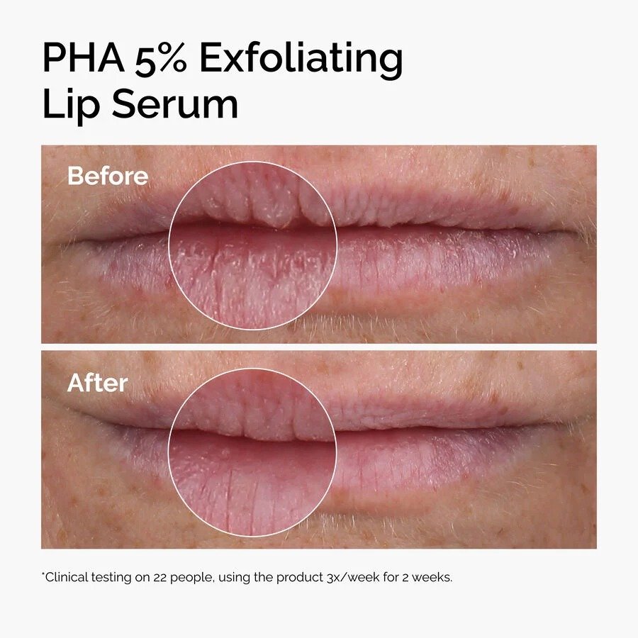 The Ordinary PHA 5% Exfoliating Lip Serum (15ml) - Image 3