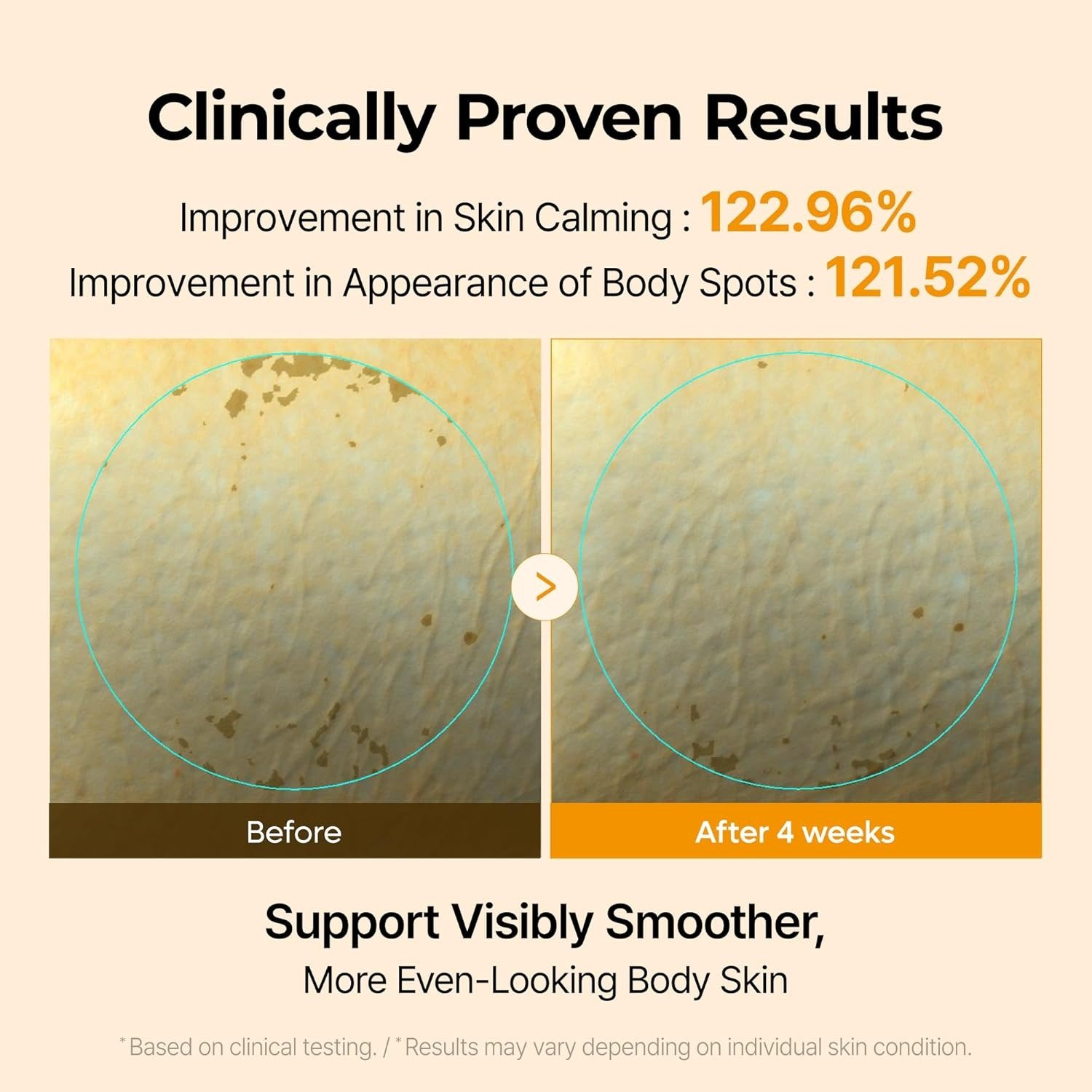 Dr. Melaxin Kojic Acid Turmeric Capsule Body Cream - Image 3