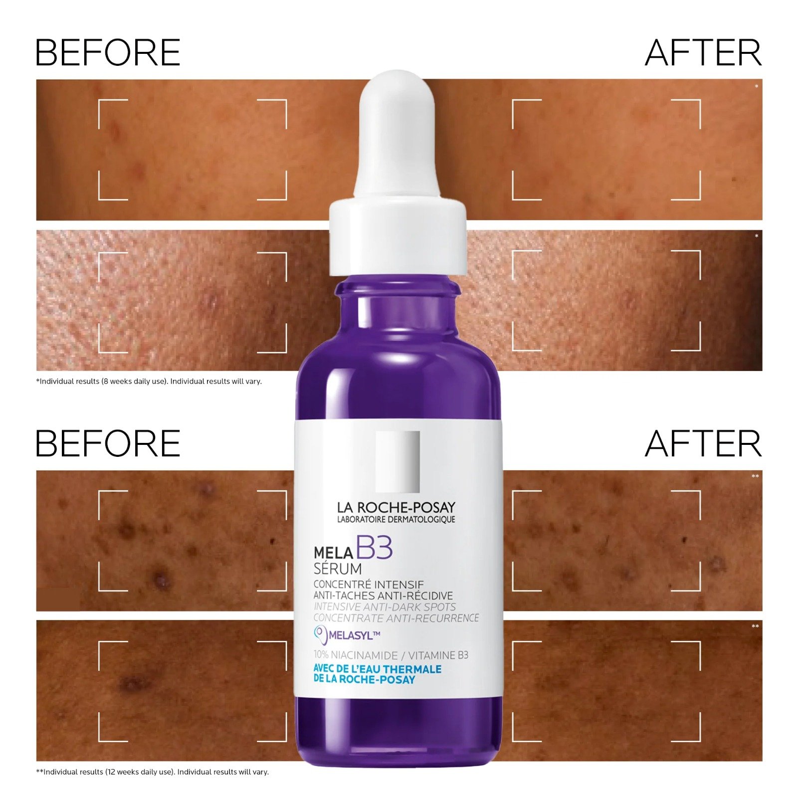 La Roche-Posay Mela B3 Concentrated Serum Dark Spots 30ml - Image 3