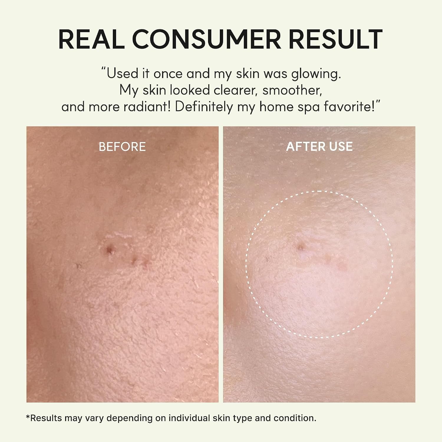 Arencia Vita Collagen Radiance Jello Mask 30g (4ea) - Image 3