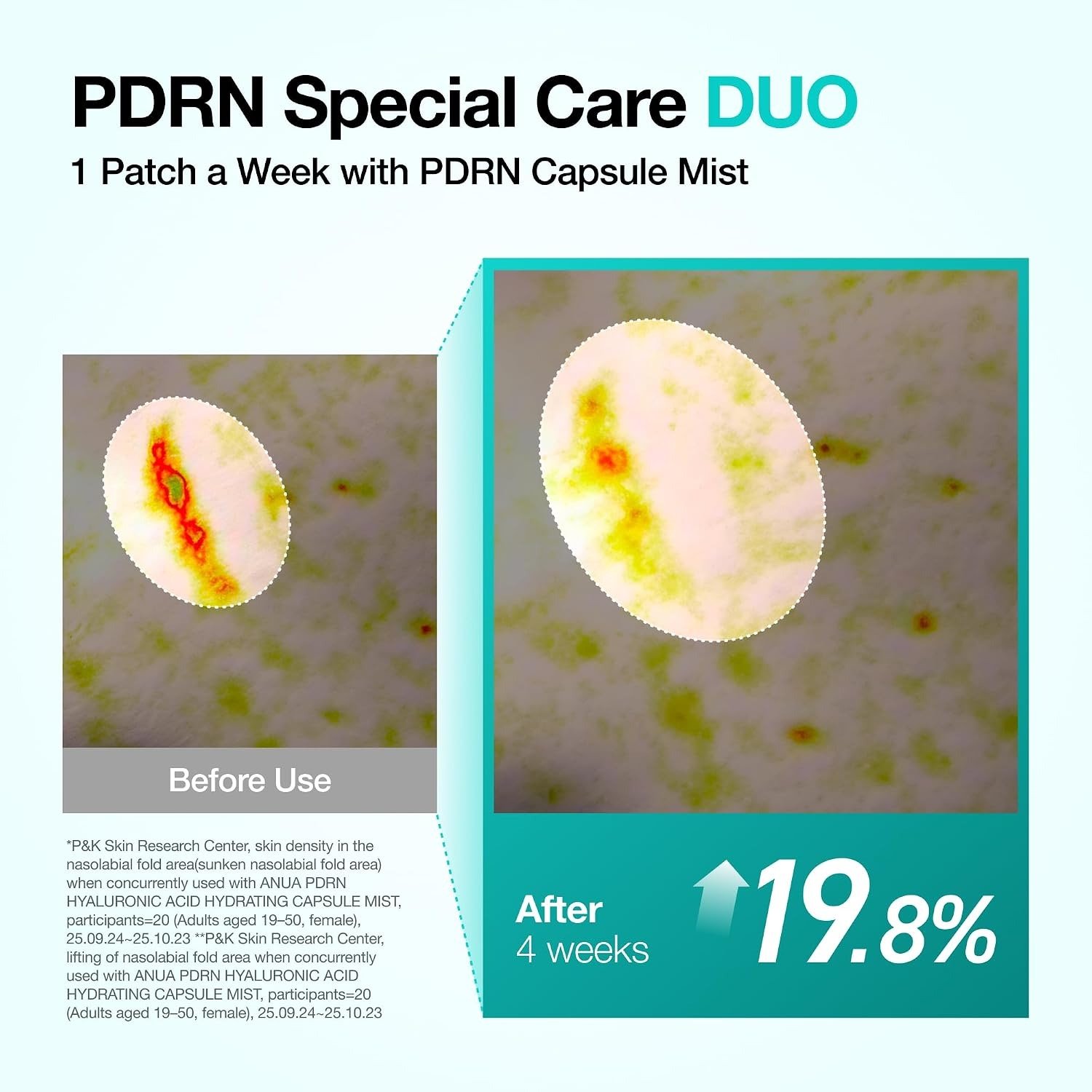 Anua PDRN Collagen Melting Patch For Glass Skin (4EA) - Image 6