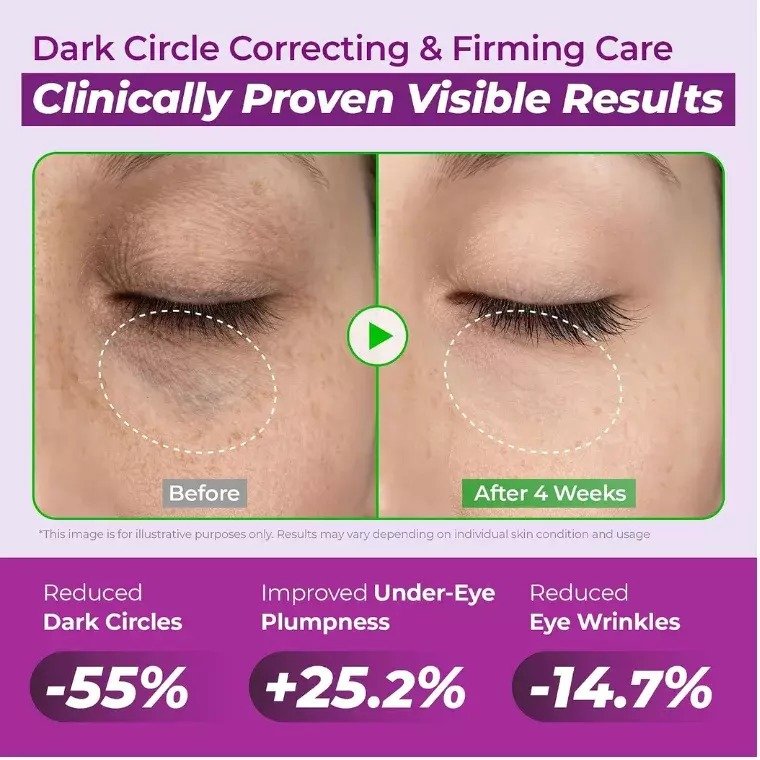 Jumiso Niacinamide 5+ Dark Circle Correcting Eye Cream (15ml) - Image 4